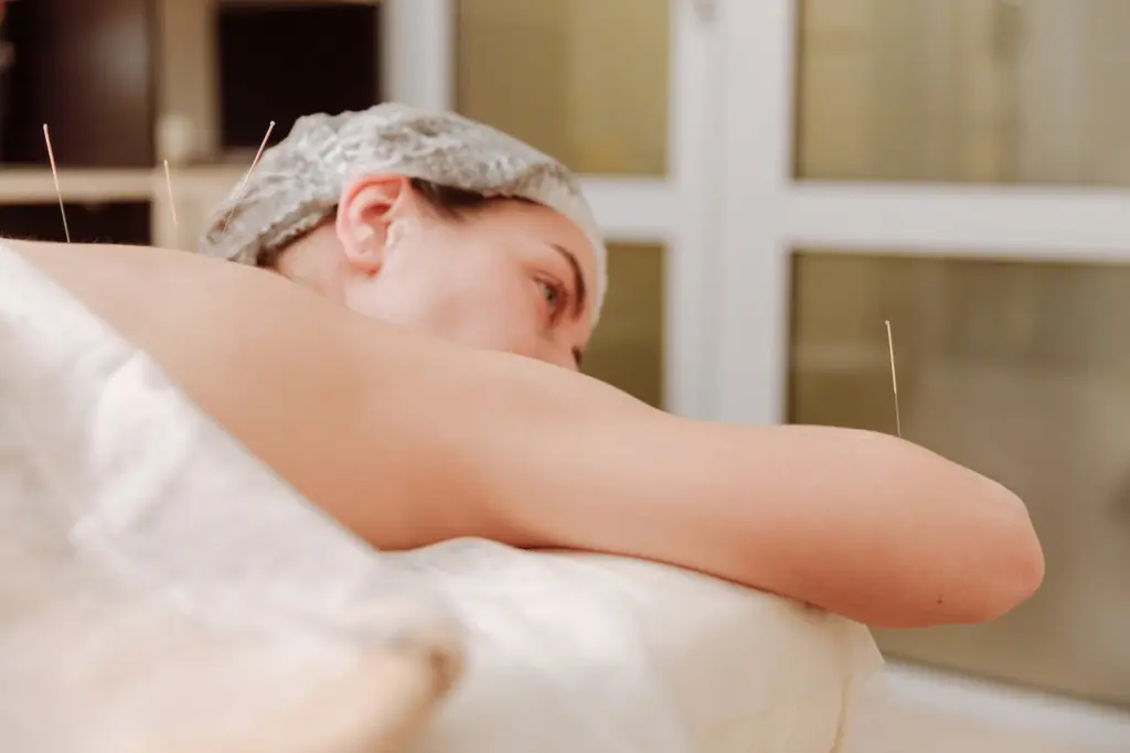 Acupuncture Science